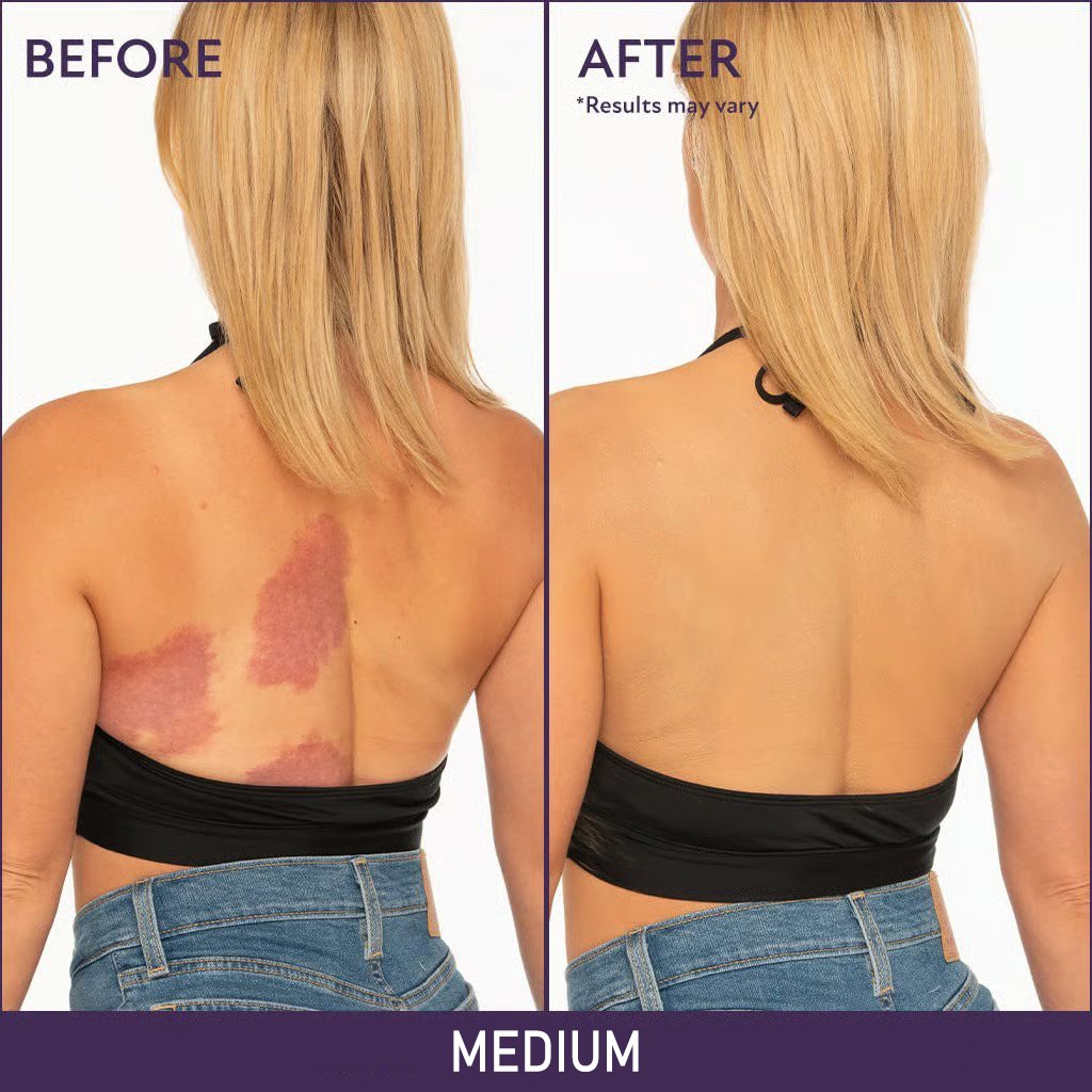 🔥 SISTE DAG 49% AVSLAG🔥Soft Matte Cream Concealer