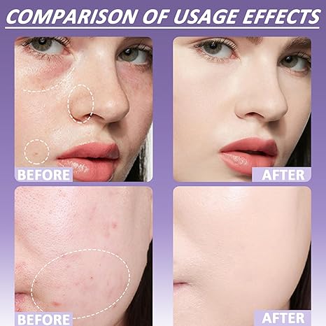 🔥 SISTE DAG 49% AVSLAG🔥Soft Matte Cream Concealer