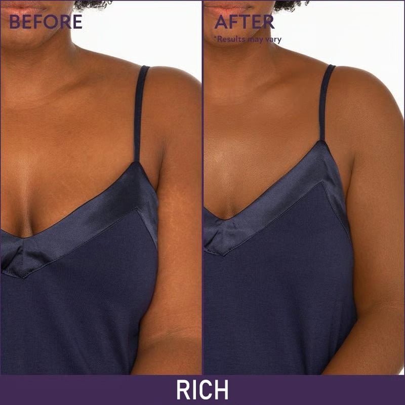 🔥 SISTE DAG 49% AVSLAG🔥Soft Matte Cream Concealer